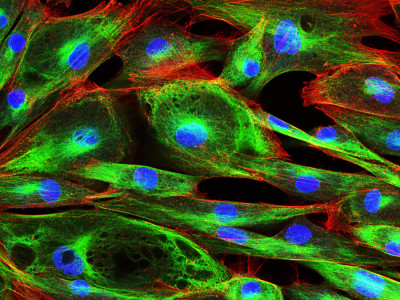 blue, green, red cell image 586706662
