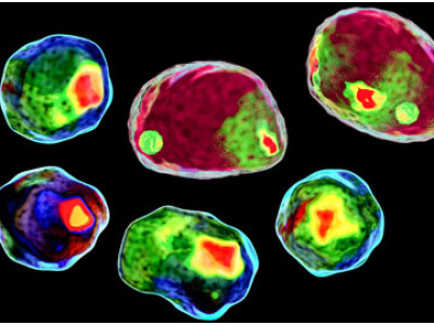 chroma fluorescence microscopy
