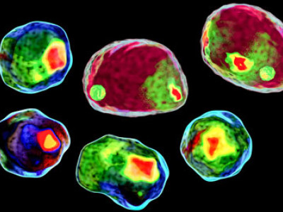chroma fluorescence microscopy