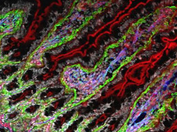 fluorescence microscopy cells red green purple